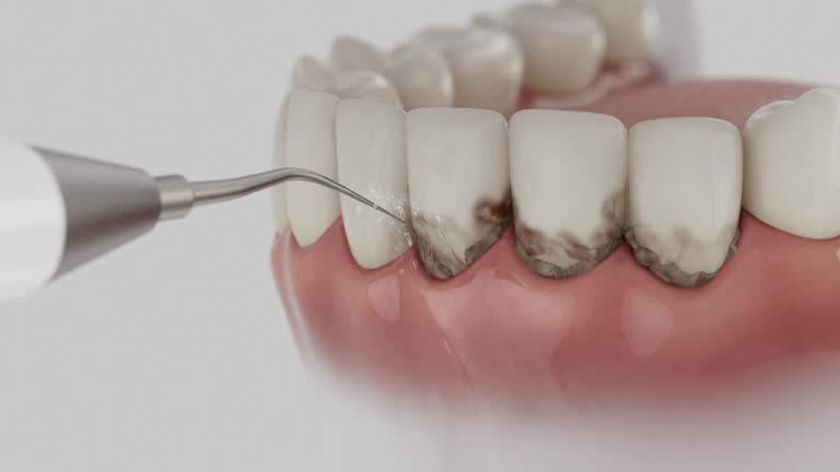 Trusted Emergency Dentist service in Lynchburg, TN - Dentist Open Now